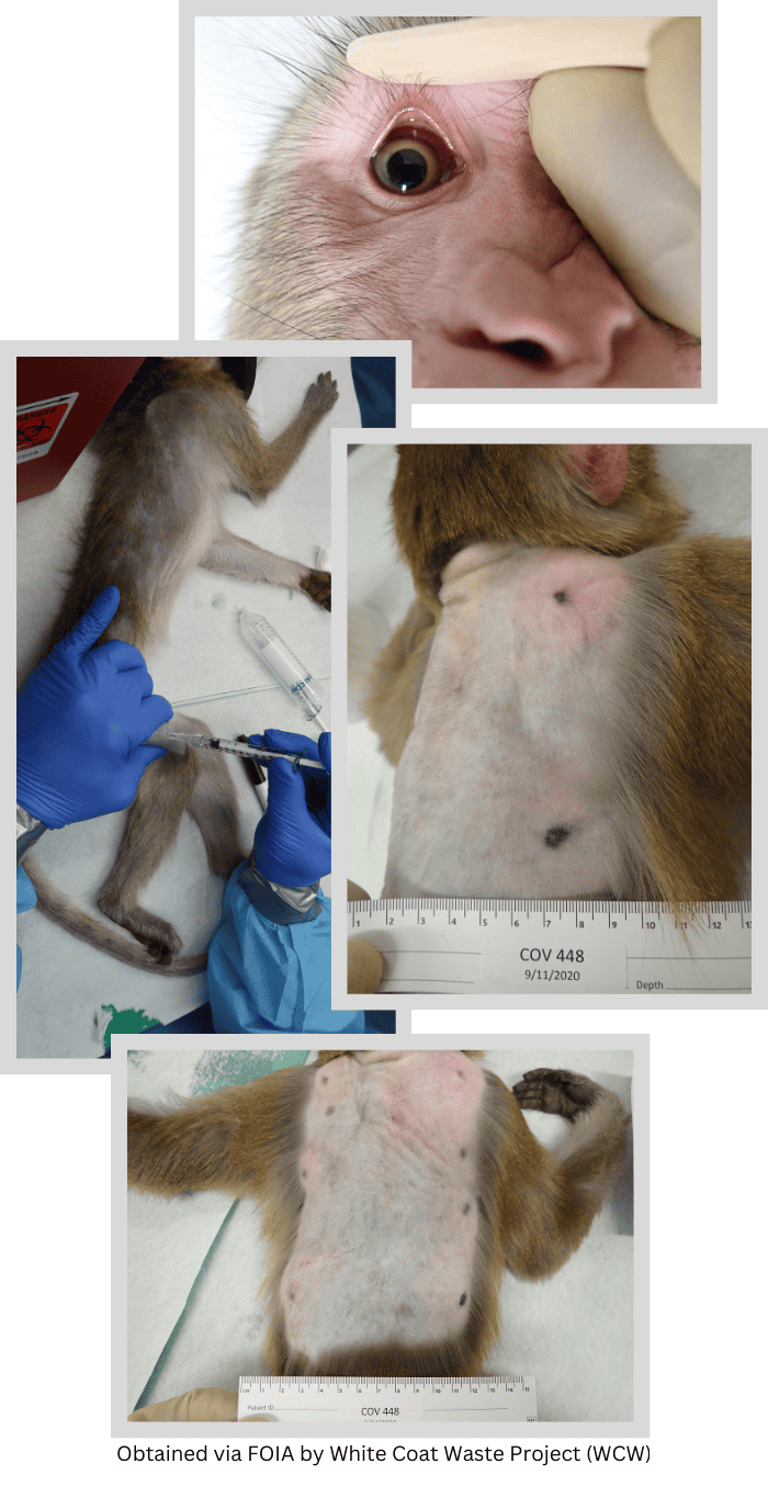 NIH Max Pain Lawsuit